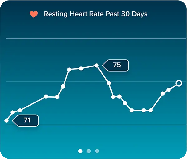 Pregnancy Fitbit Beats Per Minute Fitbit Versa Smart Fitness Watch - Main Image