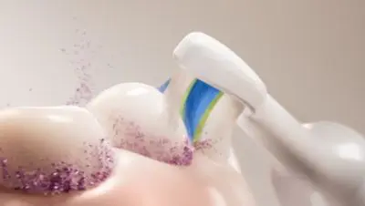 Suurepärane hambakatu eemaldamine ja valgemad hambad