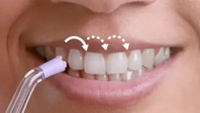 Pulse Wave tehnoloogia juhib ühe hamba juurest teiseni