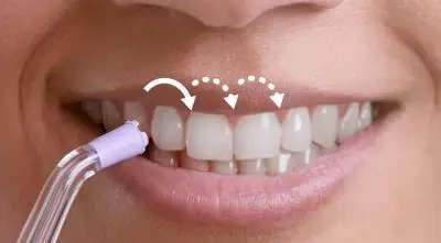 Pulse Wave tehnoloogia juhib ühe hamba juurest teiseni